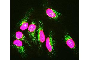 HeLa cells staining with CPCA-LaminAC (red), and counterstained with monoclonal antibody to Lysosomal Associated Membrane Protein 1 (Lamp1), MCA- 6E2 (green) and DNA (blue). (Lamin A/C Antikörper)