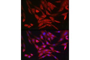 Immunofluorescence analysis of NIH/3T3 cells using MRPL28 Rabbit mAb (ABIN7268566) at dilution of 1:100 (40x lens). (MRPL28 Antikörper)
