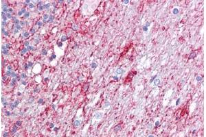 Anti-ATG9A antibody IHC staining of human brain, cerebellum. (ATG9A Antikörper  (C-Term))