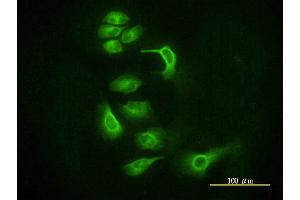 Immunofluorescence of monoclonal antibody to EIF2C2 on HeLa cell. (AGO2 Antikörper  (AA 1-377))