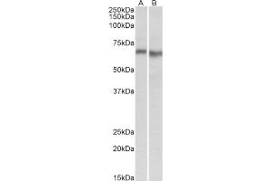 AP21300PU-N AMPK2 antibody staining of Mouse (A) and Rat (B) Heart lysate at 0. (PRKAA2 Antikörper  (Internal Region))