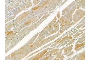 ABIN6260380 and ABIN6276612 at 1/100 staining human tongue carcinoma by IHC-P. (CA3 Antikörper  (N-Term))