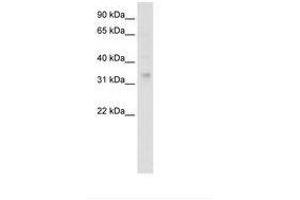 Image no. 1 for anti-Homeobox A2 (HOXA2) (AA 241-290) antibody (ABIN6736112) (HOXA2 Antikörper  (AA 241-290))