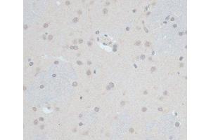 Immunohistochemistry of paraffin-embedded Rat brain using ZNF703 Polyclonal Antibody at dilution of 1:100 (40x lens). (ZNF703 Antikörper)