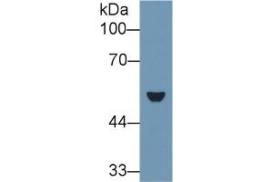 Western Blot; Sample: Rat Lung lysate; Primary Ab: 1µg/ml Rabbit Anti-Rat KRT7 Antibody Second Ab: 0. (Cytokeratin 7 Antikörper  (AA 394-457))