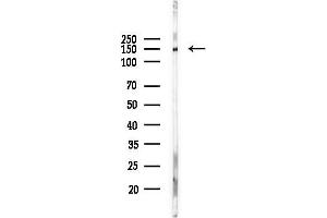 anti-Ubiquitin Specific Peptidase 48 (USP48) (C-Term) antibody