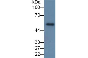 Detection of MMP8 in Porcine Skin lysate using Monoclonal Antibody to Matrix Metalloproteinase 8 (MMP8) (MMP8 Antikörper  (AA 101-467))