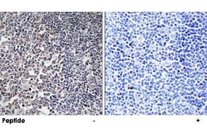 Immunohistochemistry analysis of paraffin-embedded human tonsil tissue using MRPS16 polyclonal antibody . (MRPS16 Antikörper)