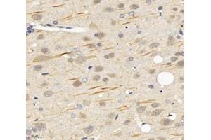 Immunohistochemistry analysis of paraffin-embedded rat brain using,SCN8A (ABIN7075647) at dilution of 1: 1200 (SCN8A Antikörper)