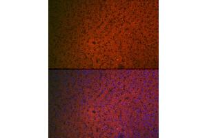 Immunofluorescence analysis of rat liver cells using Factor IX / F9 Rabbit pAb (ABIN3022173, ABIN3022174, ABIN3022175, ABIN1512886 and ABIN6218646) at dilution of 1:100 (40x lens).
