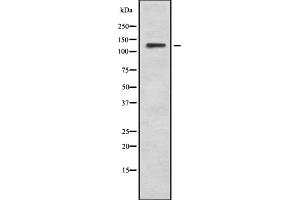 Western blot analysis of POLR3B using LOVO whole cell lysates