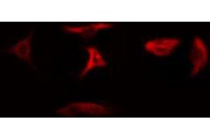 ABIN6274783 staining Hela cells by IF/ICC. (RPL5 Antikörper  (C-Term))