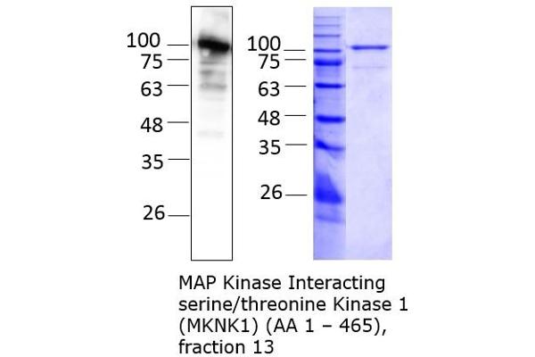 MKNK1 Protein (AA 1-465) (Strep Tag)