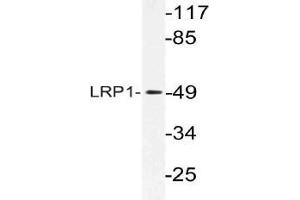 Western blot (WB) analysis of LRP1 antibody in extracts from HepG2 cells. (LRP1 Antikörper)