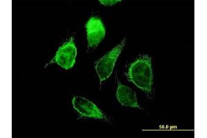 Immunofluorescence of purified MaxPab antibody to ECHS1 on HeLa cell. (ECHS1 Antikörper  (AA 1-290))