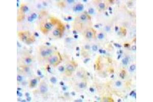 IHC-P analysis of Liver tissue, with DAB staining. (P-Selectin Antikörper  (AA 58-259))