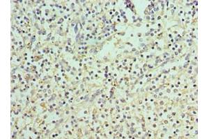 Immunohistochemistry (IHC) image for anti-Peptidyl Arginine Deiminase, Type IV (PADI4) (AA 1-250) antibody (ABIN7166400)