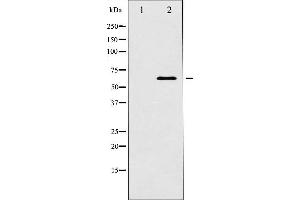 Western Blotting (WB) image for anti-Docking Protein 1, 62kDa (Downstream of tyrosine Kinase 1) (DOK1) (Internal Region) antibody (ABIN6263984)