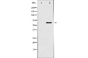 Western blot analysis of p62 Dok expression in K562 whole cell lysates,The lane on the left is treated with the antigen-specific peptide. (DOK1 Antikörper  (Internal Region))