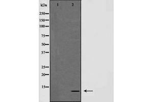 Western blot analysis of NDUFA4 expression in HepG2 cells,The lane on the left is treated with the antigen-specific peptide. (NDUFA4 Antikörper  (C-Term))