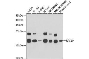 Western blot analysis of extracts of various cell lines, using RPS10 antibody (ABIN6132945, ABIN6147192, ABIN6147194 and ABIN6221686) at 1:1000 dilution. (RPS10 Antikörper  (AA 1-165))