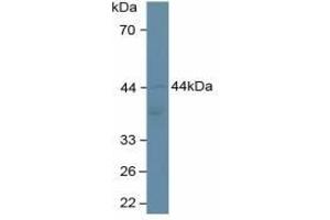 Detection of ADIPOR2 in Human Hela Cells using Polyclonal Antibody to Adiponectin Receptor 2 (ADIPOR2) (Adiponectin Receptor 2 Antikörper  (AA 2-155))