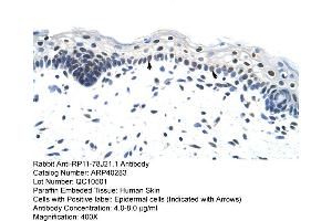 Rabbit Anti-RP11-78J21. (HNRNPA1L2 Antikörper  (N-Term))