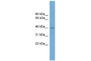 WB Suggested Anti-FBXO31 Antibody Titration: 0. (FBXO31 Antikörper  (Middle Region))