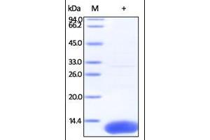 Human S100A10, His Tag on SDS-PAGE under reducing (R) condition. (S100A10 Protein (AA 1-97) (His tag))