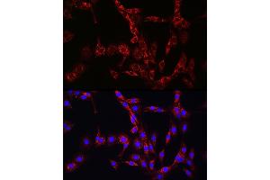 Immunofluorescence (IF) image for anti-Hexokinase 2 (HK2) (AA 1-120) antibody (ABIN3021256)