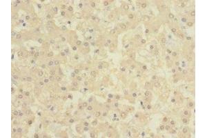 Immunohistochemistry of paraffin-embedded human liver tissue using ABIN7145876 at dilution of 1:100