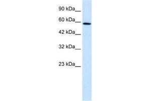Western Blotting (WB) image for anti-TBC1 Domain Family, Member 10B (TBC1D10B) antibody (ABIN2460976) (TBC1D10B Antikörper)