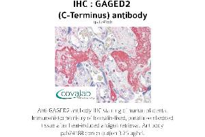 Image no. 1 for anti-X Antigen Family, Member 1B (XAGE1B) (C-Term) antibody (ABIN1734558) (XAGE1B/GAGED2 Antikörper  (C-Term))