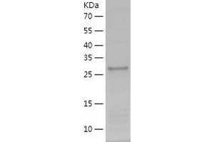 Western Blotting (WB) image for Proteasome Subunit alpha 4 (PSMA4) (AA 1-261) protein (His-IF2DI Tag) (ABIN7124634)