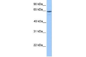 WB Suggested Anti-KIAA1958 Antibody Titration: 0. (KIAA1958 Antikörper  (C-Term))