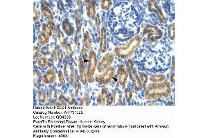 Rabbit Anti-HCLS1 Antibody  Paraffin Embedded Tissue: Human Kidney Cellular Data: Epithelial cells of renal tubule Antibody Concentration: 4.
