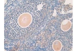 Immunohistochemistry (IHC) image for anti-Growth Differentiation Factor 5 (GDF5) (AA 358-495) antibody (ABIN7437095)