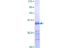 INPPL1 Protein (AA 1159-1258) (GST tag)