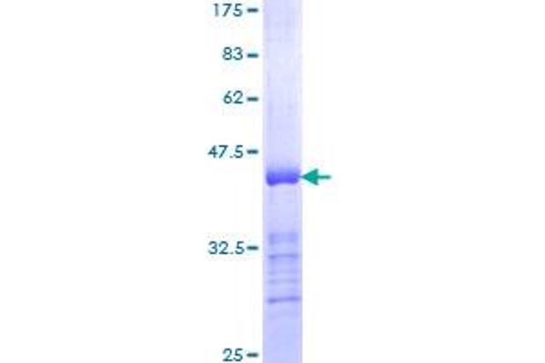 INPPL1 Protein (AA 1159-1258) (GST tag)