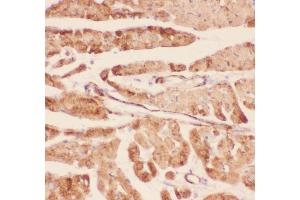 Anti-Desmin Picoband antibody,  IHC(P): Rat Cardiac Muscle Tissue