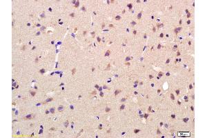 Formalin-fixed and paraffin embedded rat brain labeled with Rabbit Anti AKR1A1 Polyclonal Antibody, Unconjugated (ABIN872733) at 1:200 followed by conjugation to the secondary antibody and DAB staining (AKR1A1 Antikörper  (AA 53-130))