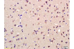 Formalin-fixed and paraffin embedded rat brain labeled with Rabbit Anti AKR1A1 Polyclonal Antibody, Unconjugated (ABIN872733) at 1:200 followed by conjugation to the secondary antibody and DAB staining