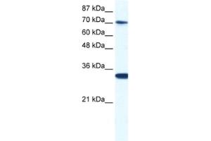 Western Blotting (WB) image for anti-CCR4-NOT Transcription Complex, Subunit 3 (CNOT3) antibody (ABIN2460917) (CNOT3 Antikörper)