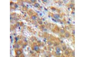 Used in DAB staining on fromalin fixed paraffin-embedded Liver tissue (SERPINA1 Antikörper  (AA 25-413))
