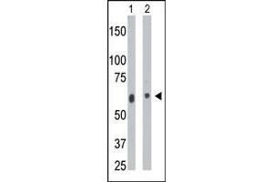 The anti-CERK Pab (ABIN391126 and ABIN2841252) is used in Western blot to detect CERK in mouse heart tissue lysate (Lane 1) and  cell lysate (Lane 2). (CERK Antikörper  (C-Term))