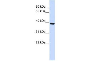 FBXO24 antibody used at 1 ug/ml to detect target protein.