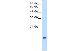PPIA antibody used at 2. (PPIA Antikörper)