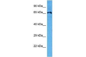 Western Blotting (WB) image for anti-Potassium Voltage-Gated Channel, Shal-Related Subfamily, Member 3 (KCND3) (C-Term) antibody (ABIN5515524)