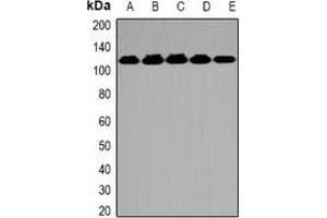 Western blot analysis of OGT expression in K562 (A), A549 (B), Hela (C), mouse spleen (D), mouse brain (E) whole cell lysates.