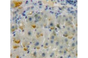 Used in DAB staining on fromalin fixed paraffin-embedded Liver tissue (ADCY9 Antikörper  (AA 1029-1282))
